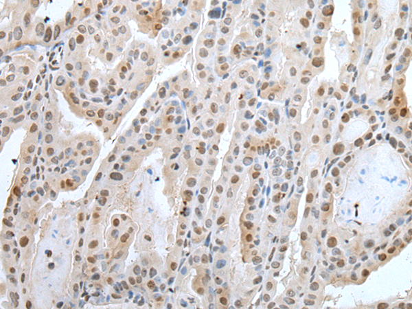 ZNF37A