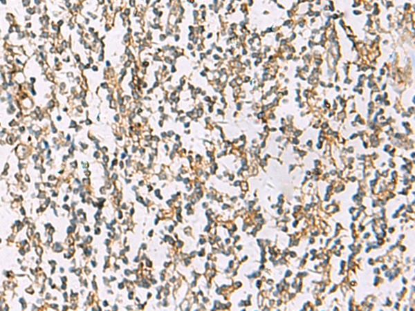 ZPBP2