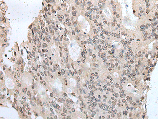 YPEL1