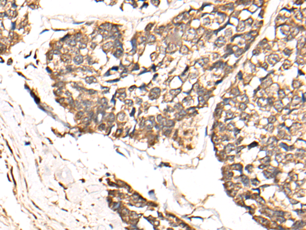 TCEAL9
