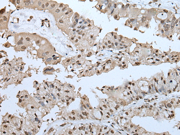 Rabbit Polyclonal Antibody to UBASH3A