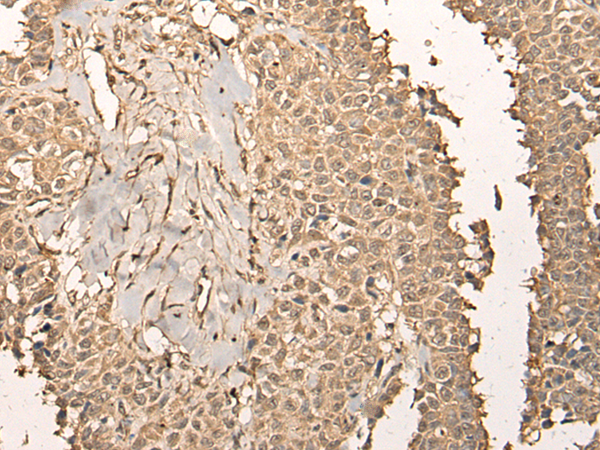 Rabbit Polyclonal Antibody to UTP11