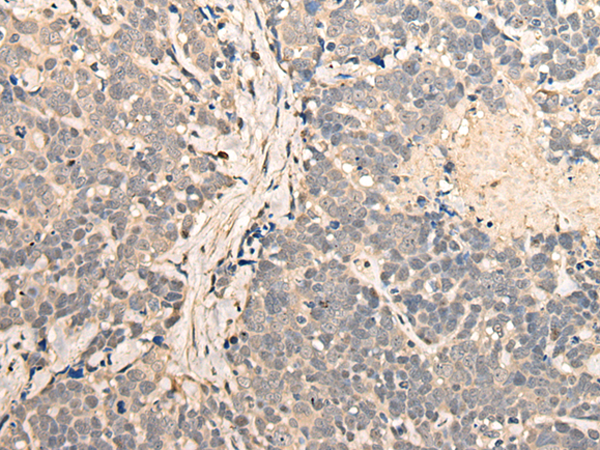 Rabbit Polyclonal Antibody to UTP11