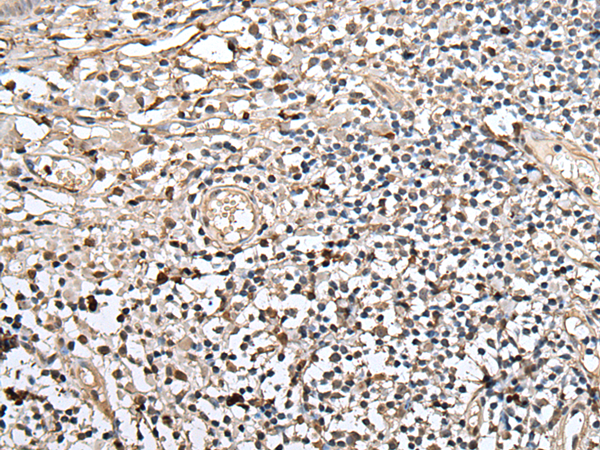 Rabbit Polyclonal Antibody to UTP3