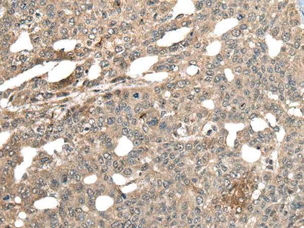 Rabbit Polyclonal Antibody to MCPH1