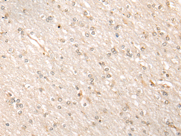 BRPF3