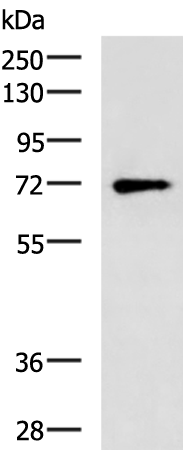BTN1A1