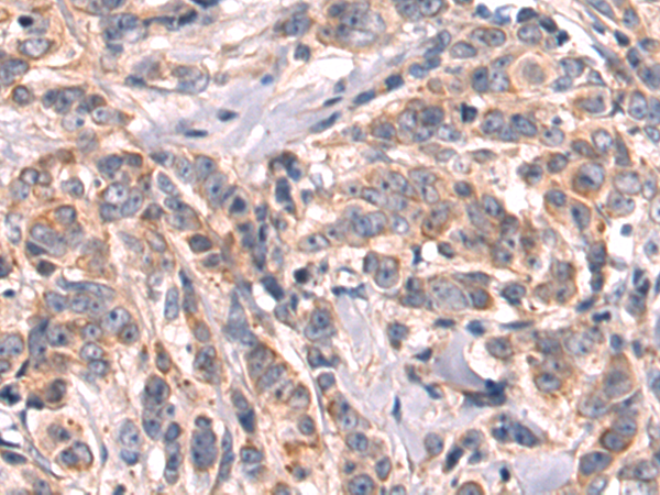 Rabbit Polyclonal Antibody to KLHL12
