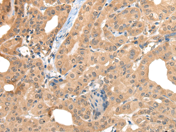 Rabbit Polyclonal Antibody to CA7