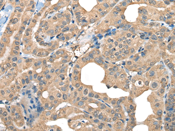 CABP5