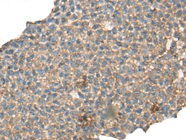 Rabbit Polyclonal Antibody to CABP5