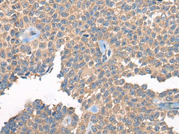 Rabbit Polyclonal Antibody to PPP3R1