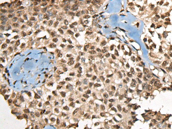 Rabbit Polyclonal Antibody to CCDC12