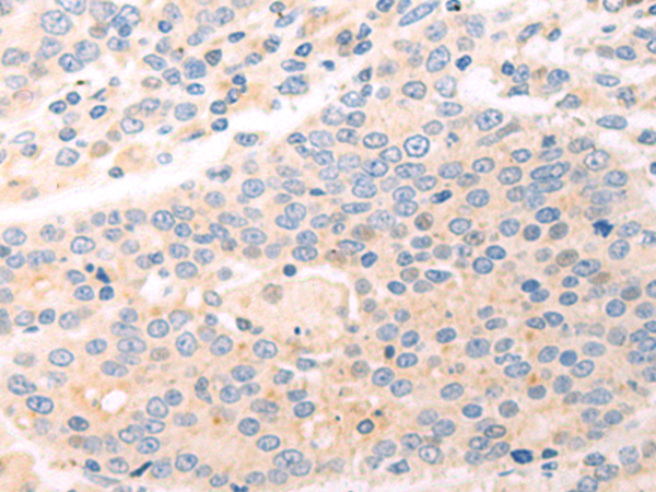 Rabbit Polyclonal Antibody to CCDC120