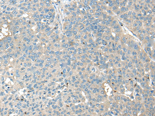 Rabbit Polyclonal Antibody to CCT6B