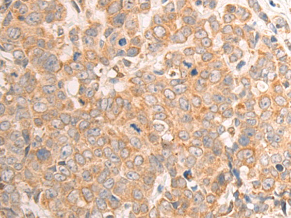 Rabbit Polyclonal Antibody to CDA