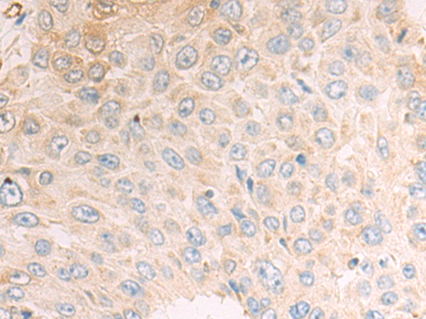 Rabbit Polyclonal Antibody to CDA