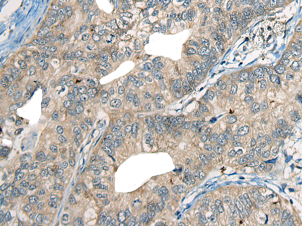 Rabbit Polyclonal Antibody to CDADC1