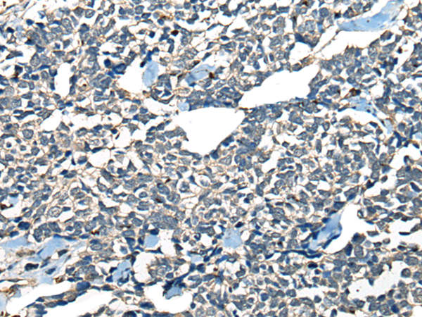 Rabbit Polyclonal Antibody to CDADC1