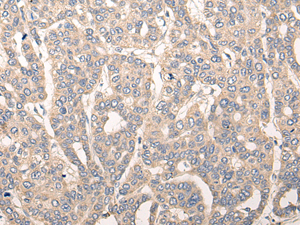 CDK2AP2