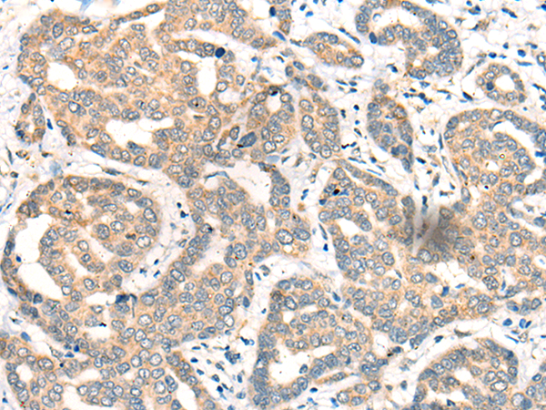 CDK2AP1