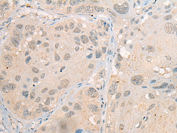 CDYL2