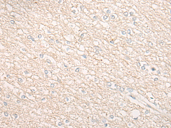 CHMP2B