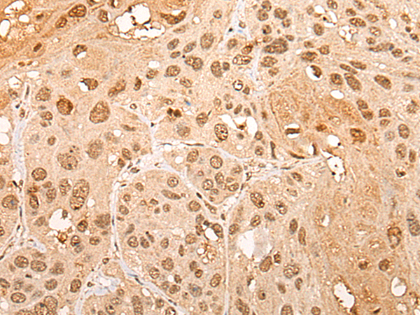 CHRAC1