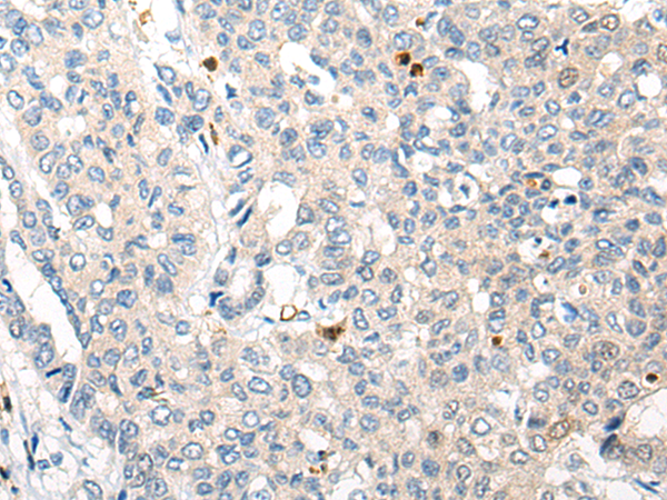 Rabbit Polyclonal Antibody to CIAO1