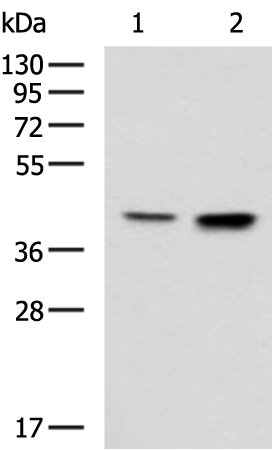 CSNK2A2