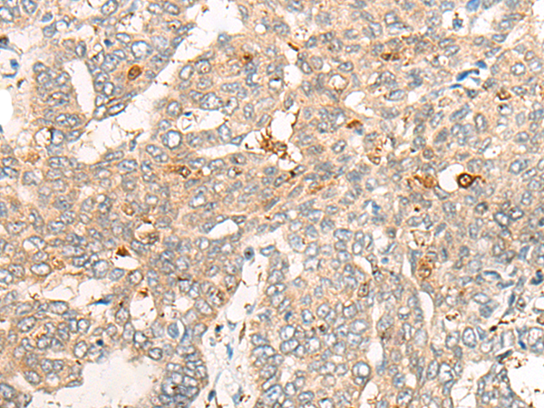 CNDP2