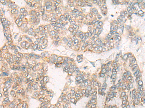 CYFIP1
