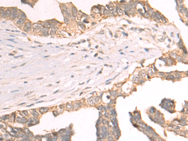 CYP20A1