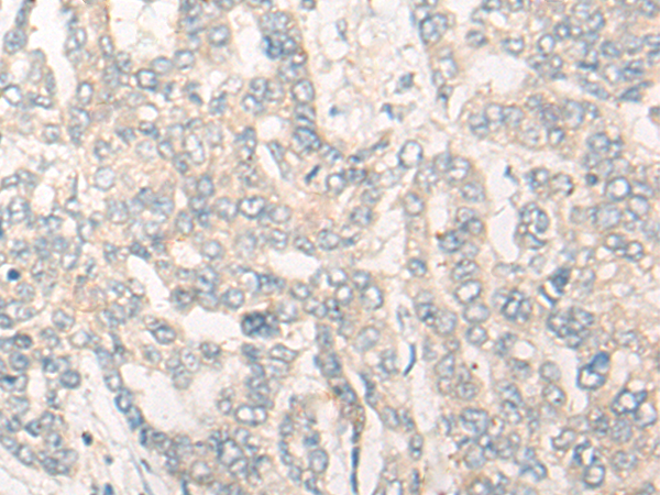 CYP26B1