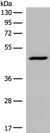 DCP2