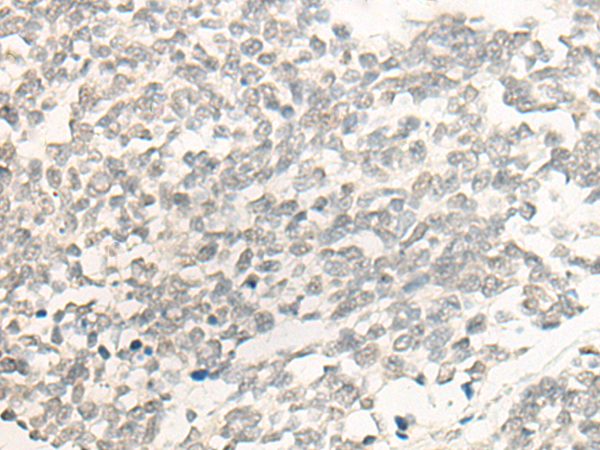 Rabbit Polyclonal Antibody to POLR1C