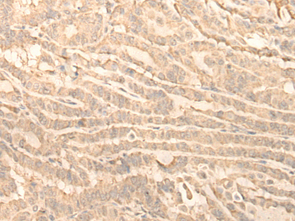 RNF146