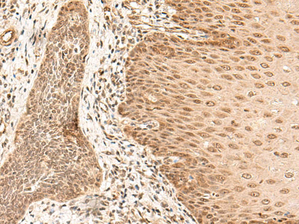 ARMC8