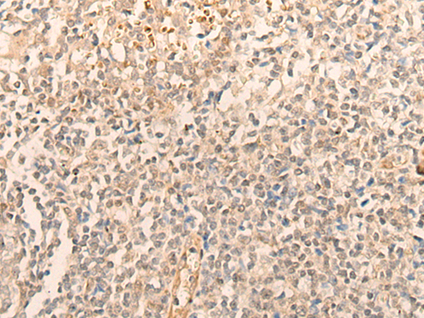 IFRD2