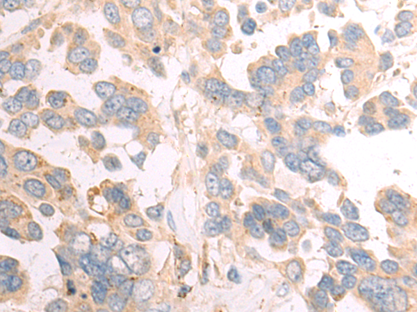 Rabbit Polyclonal Antibody to SQOR