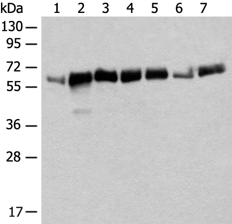 CCDC47
