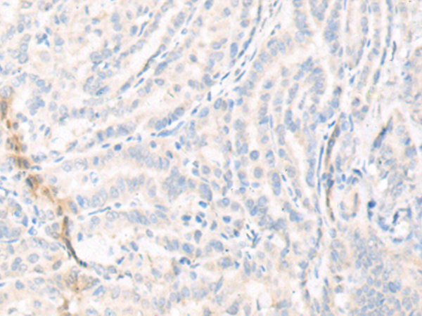 KCNS3