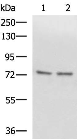 SCMH1
