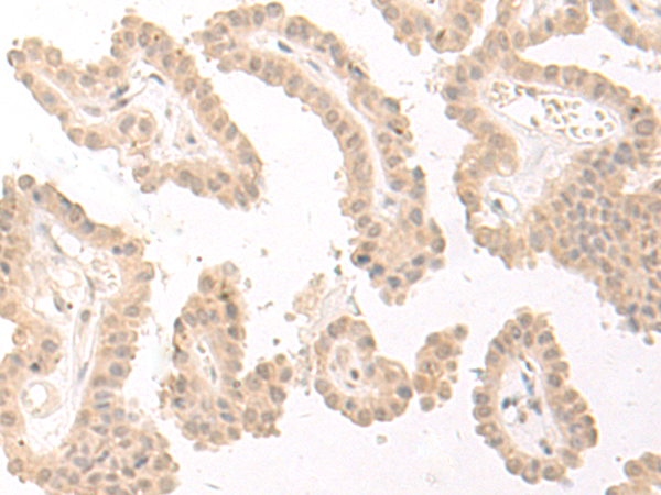 PBXIP1