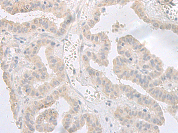 GPRASP2