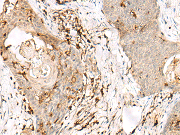 Rabbit Polyclonal Antibody to OVOL2