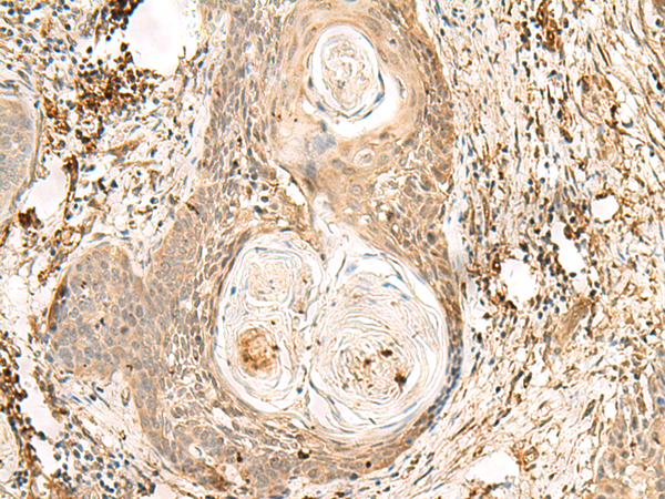 ZNF397