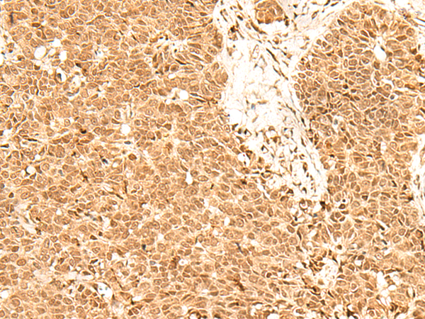 Rabbit Polyclonal Antibody to ADRM1