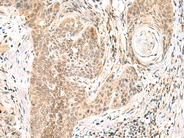 GPSM1