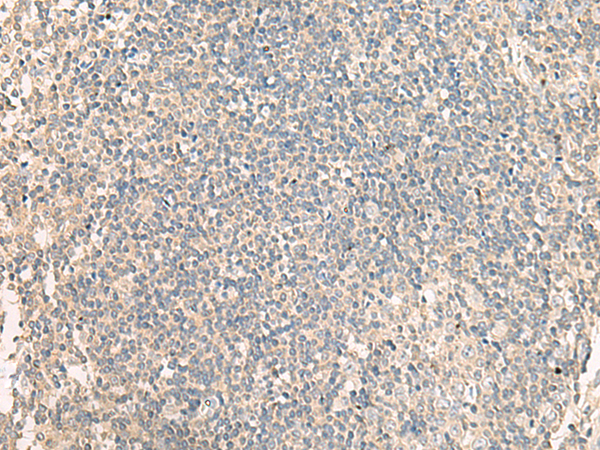 NRBP1